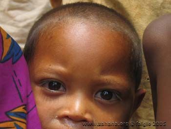 Fiadanana, Madagascar, children in 2005