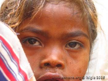 Fiadanana, Madagascar, children in 2005